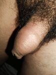 Teen boy: 4 Nude Pics