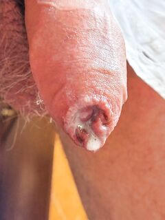Sehnsucht: 10 Nude Pics
