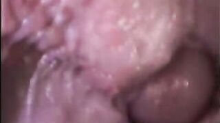 Camera inside a gay ass part II